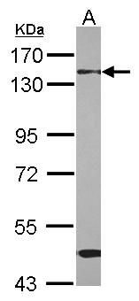 RBM26 / SE70 Antibody - Sample (30 ug of whole cell lysate) A: HepG2 7.5% SDS PAGE RBM26 antibody diluted at 1:1000