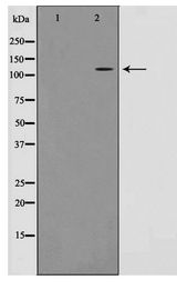 RBM26 / SE70 Antibody - Western blot of Jurkat cell lysate using RBM26 Antibody