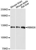 RBM26 / SE70 Antibody - Western blot analysis of extracts of various cell lines, using RBM26 antibody at 1:3000 dilution. The secondary antibody used was an HRP Goat Anti-Rabbit IgG (H+L) at 1:10000 dilution. Lysates were loaded 25ug per lane and 3% nonfat dry milk in TBST was used for blocking. An ECL Kit was used for detection and the exposure time was 90s.