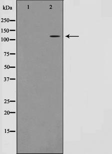 RBM26 / SE70 Antibody - Western blot analysis on Jurkat cell lysates using RBM26 antibody. The lane on the left is treated with the antigen-specific peptide.