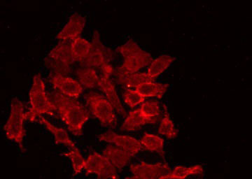 RBM26 / SE70 Antibody - Staining HeLa cells by IF/ICC. The samples were fixed with PFA and permeabilized in 0.1% Triton X-100, then blocked in 10% serum for 45 min at 25°C. The primary antibody was diluted at 1:200 and incubated with the sample for 1 hour at 37°C. An Alexa Fluor 594 conjugated goat anti-rabbit IgG (H+L) Ab, diluted at 1/600, was used as the secondary antibody.