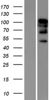 RBM26 / SE70 Protein - Western validation with an anti-DDK antibody * L: Control HEK293 lysate R: Over-expression lysate