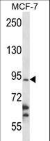 RBM28 Antibody - RBM28 Antibody western blot of MCF-7 cell line lysates (35 ug/lane). The RBM28 antibody detected the RBM28 protein (arrow).