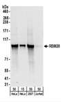 RBM28 Antibody - Detection of Human RBM28 by Western Blot. Samples: Whole cell lysate from HeLa (15 and 50 ug), 293T (50 ug), and Jurkat (50 ug) cells. Antibodies: Affinity purified rabbit anti-RBM28 antibody used for WB at 0.1 ug/ml. Detection: Chemiluminescence with an exposure time of 10 seconds.