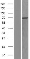 RBM28 Protein - Western validation with an anti-DDK antibody * L: Control HEK293 lysate R: Over-expression lysate