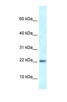 RBM3 Antibody - RBM3 antibody Western blot of Rat Lung lysate. Antibody concentration 1 ug/ml.  This image was taken for the unconjugated form of this product. Other forms have not been tested.