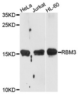 RBM3 Antibody - Western blot analysis of extracts of various cells.