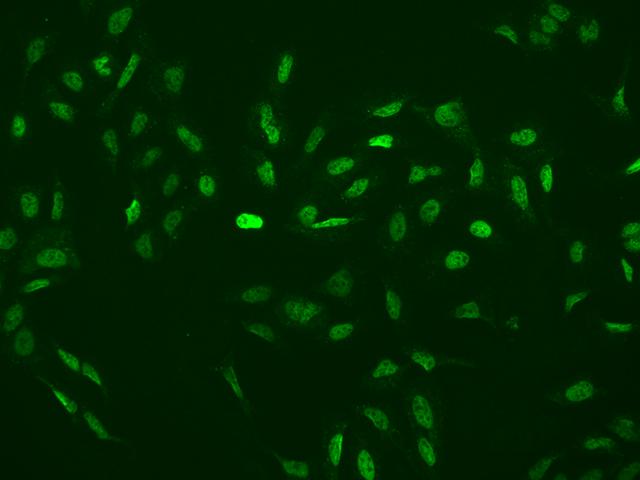 RBM3 Antibody - Immunofluorescence staining of RBM3 in U2OS cells. Cells were fixed with 4% PFA, permeabilzed with 0.1% Triton X-100 in PBS, blocked with 10% serum, and incubated with rabbit anti-Human RBM3 polyclonal antibody (dilution ratio 1:200) at 4°C overnight. Then cells were stained with the Alexa Fluor 488-conjugated Goat Anti-rabbit IgG secondary antibody (green). Positive staining was localized to Nucleus.