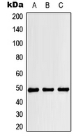 RBM34 Antibody - Western blot analysis of RBM34 expression in HeLa (A); mouse liver (B); H9C2 (C) whole cell lysates.