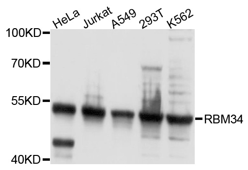 RBM34 Antibody - Western blot analysis of extracts of various cell lines, using RBM34 antibody at 1:1000 dilution. The secondary antibody used was an HRP Goat Anti-Rabbit IgG (H+L) at 1:10000 dilution. Lysates were loaded 25ug per lane and 3% nonfat dry milk in TBST was used for blocking. An ECL Kit was used for detection and the exposure time was 5s.