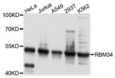 RBM34 Antibody - Western blot analysis of extracts of various cell lines, using RBM34 antibody at 1:1000 dilution. The secondary antibody used was an HRP Goat Anti-Rabbit IgG (H+L) at 1:10000 dilution. Lysates were loaded 25ug per lane and 3% nonfat dry milk in TBST was used for blocking. An ECL Kit was used for detection and the exposure time was 5s.