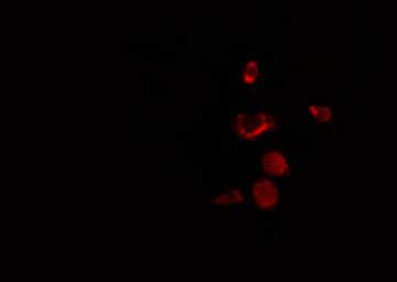 RBM34 Antibody - Staining NIH-3T3 cells by IF/ICC. The samples were fixed with PFA and permeabilized in 0.1% Triton X-100, then blocked in 10% serum for 45 min at 25°C. The primary antibody was diluted at 1:200 and incubated with the sample for 1 hour at 37°C. An Alexa Fluor 594 conjugated goat anti-rabbit IgG (H+L) Ab, diluted at 1/600, was used as the secondary antibody.