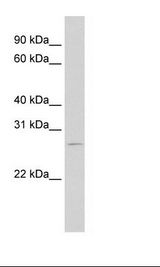 RBM38 Antibody - RPM18226 Cell Lysate.  This image was taken for the unconjugated form of this product. Other forms have not been tested.