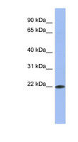 RBM38 Antibody - RBM38 antibody Western blot of HT1080 cell lysate. This image was taken for the unconjugated form of this product. Other forms have not been tested.