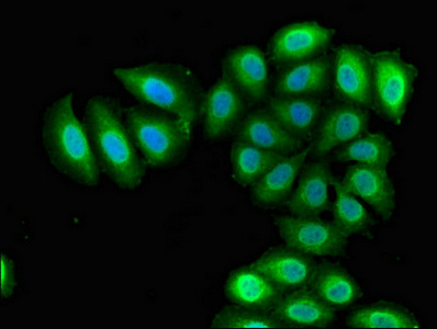 RBM38 Antibody - Immunofluorescent analysis of A549 cells diluted at 1:100 and Alexa Fluor 488-congugated AffiniPure Goat Anti-Rabbit IgG(H+L)