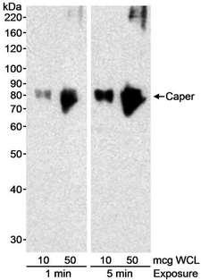 RBM39 Antibody - Detection of Human Caper by Western Blot. Samples: Whole cell lysate (10 and 50 ug) from HeLa cells. Antibody: Affinity purified rabbit anti-Caper antibody used at 0.1 ug/ml. Detection: Chemiluminescence with exposure times indicated.