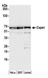 RBM39 Antibody - Detection of human Caper by western blot. Samples: Whole cell lysate (50 µg) from HeLa, HEK293T, and Jurkat cells prepared using NETN lysis buffer. Antibody: Affinity purified rabbit anti-Caper antibody used for WB at 0.1 µg/ml. Detection: Chemiluminescence with an exposure time of 10 seconds.