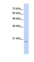 RBM39 Antibody - RBM39 antibody Western blot of Transfected 293T cell lysate. This image was taken for the unconjugated form of this product. Other forms have not been tested.