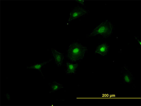 RBM39 Antibody - Immunofluorescence of monoclonal antibody to RNPC2 on HeLa cell. [antibody concentration 40 ug/ml]