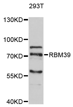 RBM39 Antibody - Western blot analysis of extracts of 293T cells.