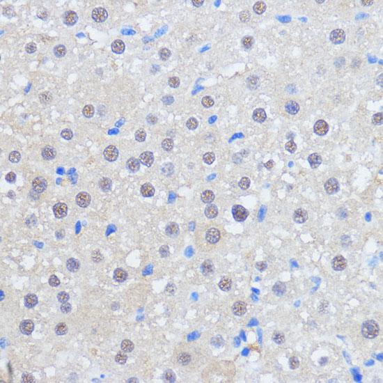 RBM39 Antibody - Immunohistochemistry of paraffin-embedded Rat liver using RBM39 Polyclonal Antibody at dilution of 1:100 (40x lens).