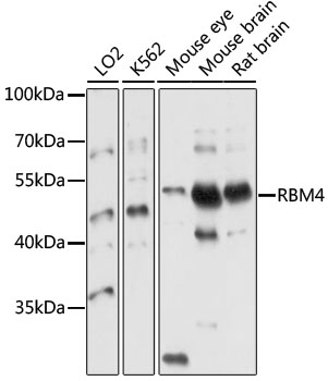 RBM4 / LARK Antibody - Western blot analysis of extracts of various cell lines, using RBM4 antibody at 1:1000 dilution. The secondary antibody used was an HRP Goat Anti-Rabbit IgG (H+L) at 1:10000 dilution. Lysates were loaded 25ug per lane and 3% nonfat dry milk in TBST was used for blocking. An ECL Kit was used for detection and the exposure time was 10s.