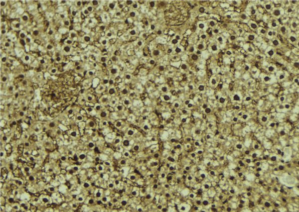 RBM4 / LARK Antibody - 1:100 staining mouse liver tissue by IHC-P. The sample was formaldehyde fixed and a heat mediated antigen retrieval step in citrate buffer was performed. The sample was then blocked and incubated with the antibody for 1.5 hours at 22°C. An HRP conjugated goat anti-rabbit antibody was used as the secondary.