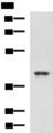 RBM4 / LARK Antibody - Western blot analysis of K562 and HepG2 cell lysates  using RBM4 Polyclonal Antibody at dilution of 1:750
