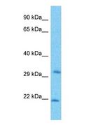 RBM41 Antibody - Western blot of RBM41 Antibody with ACHN Whole Cell lysate.  This image was taken for the unconjugated form of this product. Other forms have not been tested.