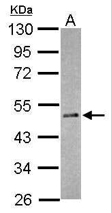 RBM41 Antibody - Sample (30 ug of whole cell lysate) A: HeLa nucleus 10% SDS PAGE RBM41 antibody diluted at 1:500