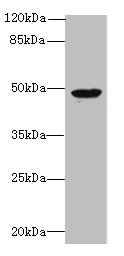 RBM41 Antibody - Western blot All lanes: RBM41 antibody at 1.5µg/ml + Hela whole cell lysate Secondary Goat polyclonal to rabbit IgG at 1/10000 dilution Predicted band size: 48, 47, 36 kDa Observed band size: 48 kDa