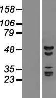 RBM41 Protein - Western validation with an anti-DDK antibody * L: Control HEK293 lysate R: Over-expression lysate
