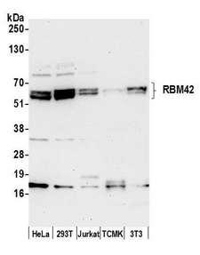 RBM42 Antibody - Detection of human and mouse RBM42 by western blot. Samples: Whole cell lysate (50 µg) from HeLa, HEK293T, Jurkat, mouse TCMK-1, and mouse NIH 3T3 cells prepared using NETN lysis buffer. Antibody: Affinity purified rabbit anti-RBM42 antibody used for WB at 0.4 µg/ml. Detection: Chemiluminescence with an exposure time of 30 seconds.
