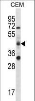 RBM42 Antibody - RBM42 Antibody western blot of CEM cell line lysates (35 ug/lane). The RBM42 antibody detected the RBM42 protein (arrow).