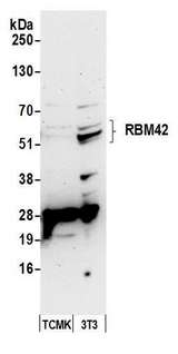 RBM42 Antibody - Detection of mouse RBM42 by western blot. Samples: Whole cell lysate (50 µg) from TCMK-1 and NIH 3T3 cells prepared using NETN lysis buffer. Antibody: Affinity purified rabbit anti-RBM42 antibody used for WB at 0.1 µg/ml. Detection: Chemiluminescence with an exposure time of 75 seconds.