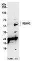 RBM42 Antibody - Detection of mouse RBM42 by western blot. Samples: Whole cell lysate (50 µg) from TCMK-1 and NIH 3T3 cells prepared using NETN lysis buffer. Antibody: Affinity purified rabbit anti-RBM42 antibody used for WB at 0.1 µg/ml. Detection: Chemiluminescence with an exposure time of 75 seconds.
