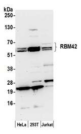 RBM42 Antibody - Detection of human RBM42 by western blot. Samples: Whole cell lysate (50 µg) from HeLa, HEK293T, and Jurkat cells prepared using NETN lysis buffer. Antibody: Affinity purified rabbit anti-RBM42 antibody used for WB at 0.1 µg/ml. Detection: Chemiluminescence with an exposure time of 30 seconds.