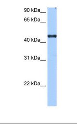 RBM42 Antibody - HepG2 cell lysate. Antibody concentration: 0.5 ug/ml. Gel concentration: 12%.  This image was taken for the unconjugated form of this product. Other forms have not been tested.