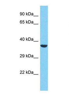 RBM43 Antibody - Western blot of Human HepG2. RBM43 antibody dilution 1.0 ug/ml.  This image was taken for the unconjugated form of this product. Other forms have not been tested.