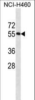 RBM45 / DRB1 Antibody - RBM45 Antibody western blot of NCI-H460 cell line lysates (35 ug/lane). The RBM45 antibody detected the RBM45 protein (arrow).