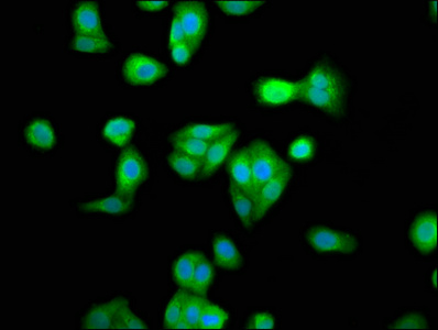 RBM45 / DRB1 Antibody - Immunofluorescence staining of HepG2 cells at a dilution of 1:33, counter-stained with DAPI. The cells were fixed in 4% formaldehyde, permeabilized using 0.2% Triton X-100 and blocked in 10% normal Goat Serum. The cells were then incubated with the antibody overnight at 4 °C.The secondary antibody was Alexa Fluor 488-congugated AffiniPure Goat Anti-Rabbit IgG (H+L) .