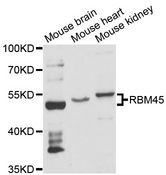 RBM45 / DRB1 Antibody - Western blot analysis of extracts of various cell lines, using RBM45 antibody at 1:3000 dilution. The secondary antibody used was an HRP Goat Anti-Rabbit IgG (H+L) at 1:10000 dilution. Lysates were loaded 25ug per lane and 3% nonfat dry milk in TBST was used for blocking. An ECL Kit was used for detection and the exposure time was 10s.