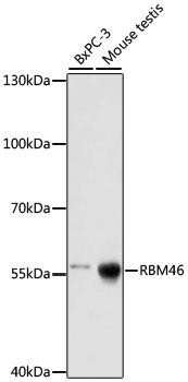 RBM46 Antibody - Western blot analysis of extracts of various cell lines using RBM46 Polyclonal Antibody at dilution of 1:1000.