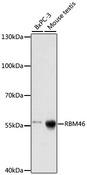 RBM46 Antibody - Western blot analysis of extracts of various cell lines using RBM46 Polyclonal Antibody at dilution of 1:1000.