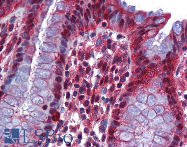 RBM47 Antibody - Anti-RBM47 antibody IHC of human colon. Immunohistochemistry of formalin-fixed, paraffin-embedded tissue after heat-induced antigen retrieval. Antibody concentration 5 ug/ml.  This image was taken for the unconjugated form of this product. Other forms have not been tested.