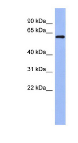 RBM47 Antibody - RBM47 antibody Western blot of NCI-H226 cell lysate. This image was taken for the unconjugated form of this product. Other forms have not been tested.