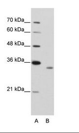 RBM4B Antibody - A: Marker, B: Jurkat Cell Lysate.  This image was taken for the unconjugated form of this product. Other forms have not been tested.