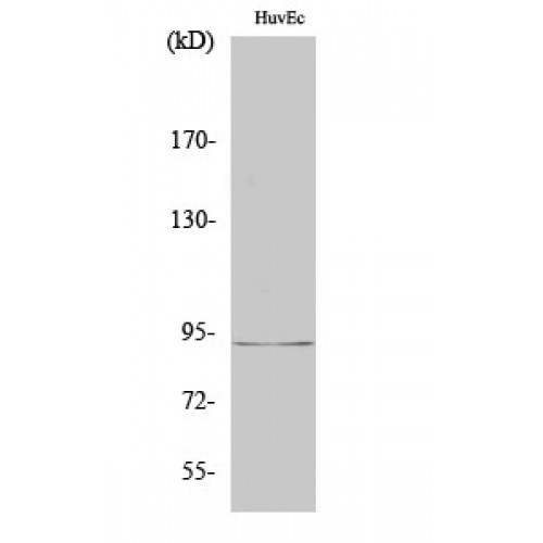 RBM5 / G15 Antibody - Western blot of LUCA15 antibody