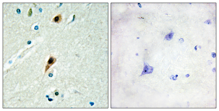 RBM5 / G15 Antibody - Immunohistochemistry analysis of paraffin-embedded human brain tissue, using RBM5 Antibody. The picture on the right is blocked with the synthesized peptide.