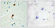 RBM5 / G15 Antibody - Immunohistochemistry analysis of paraffin-embedded human brain tissue, using RBM5 Antibody. The picture on the right is blocked with the synthesized peptide.